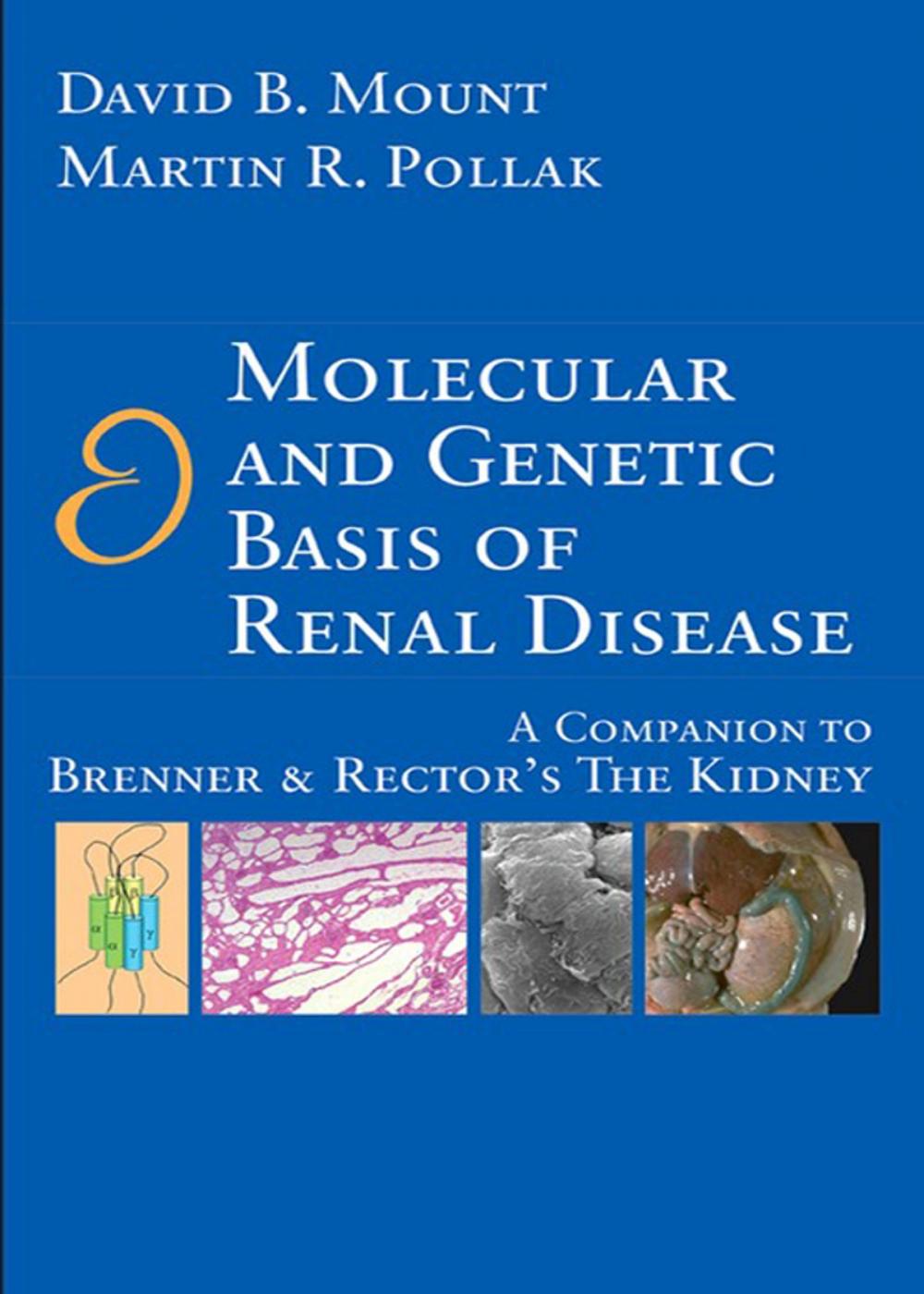 Big bigCover of Molecular and Genetic Basis of Renal Disease E-Book