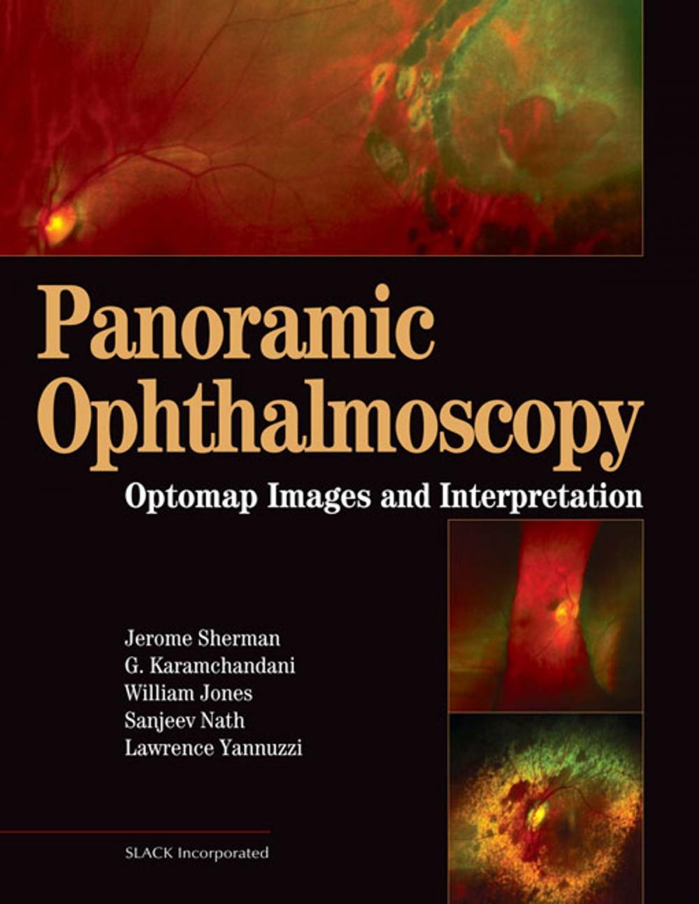 Big bigCover of Panoramic Ophthalmoscopy