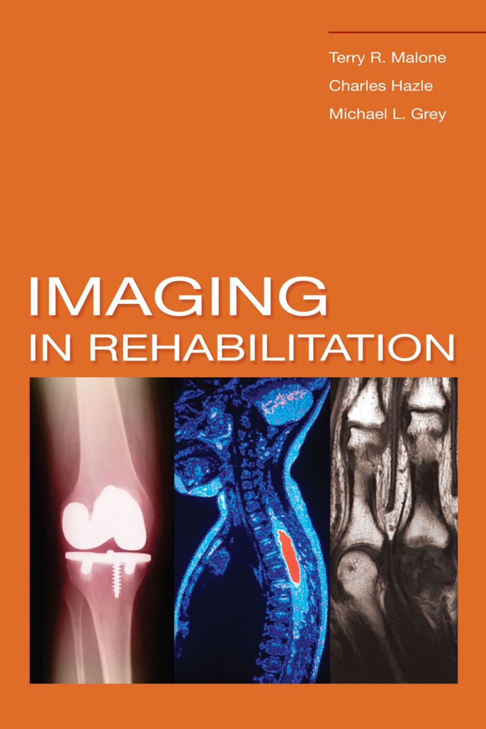 Big bigCover of Imaging In Rehabilitation