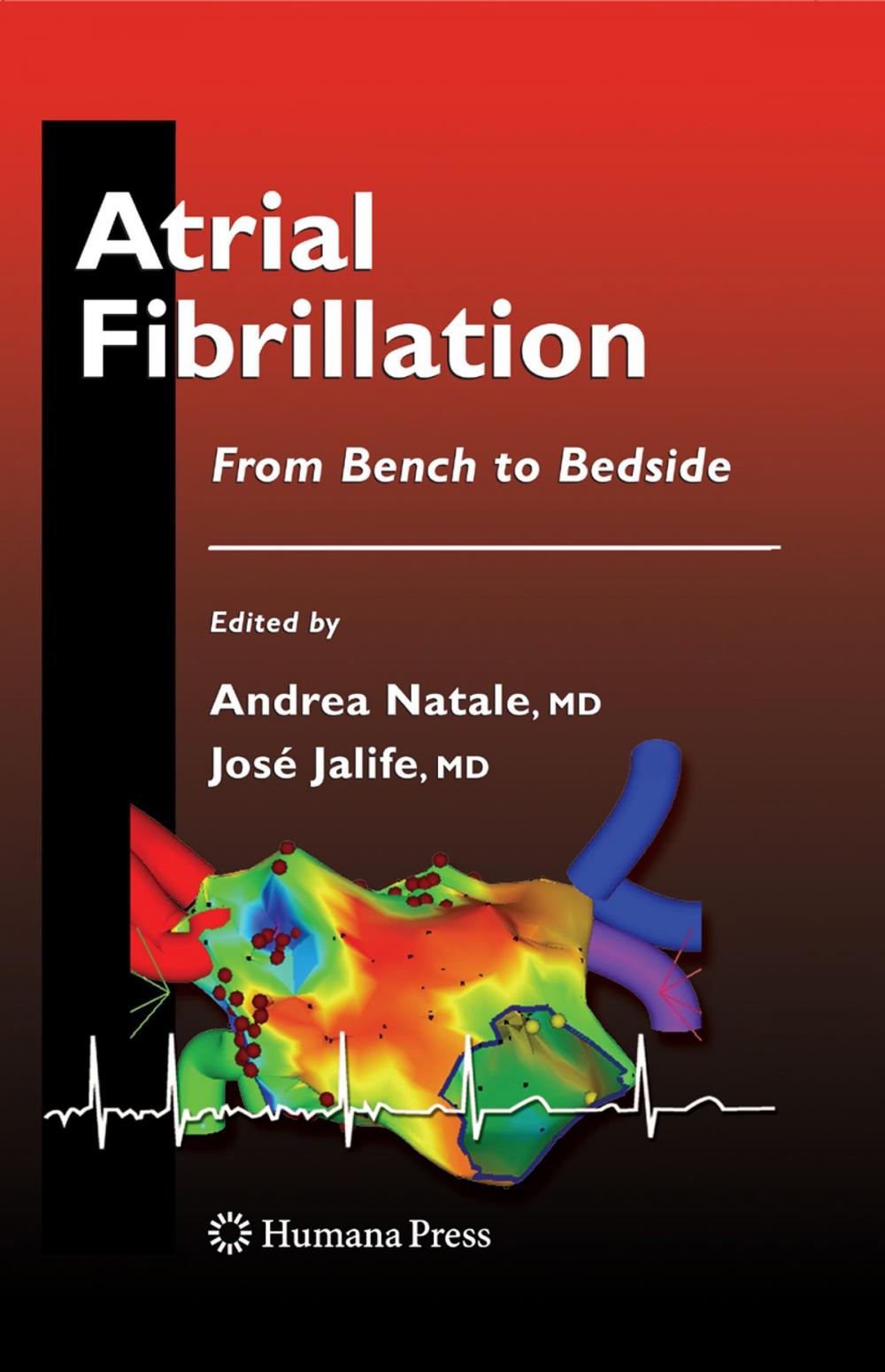 Big bigCover of Atrial Fibrillation