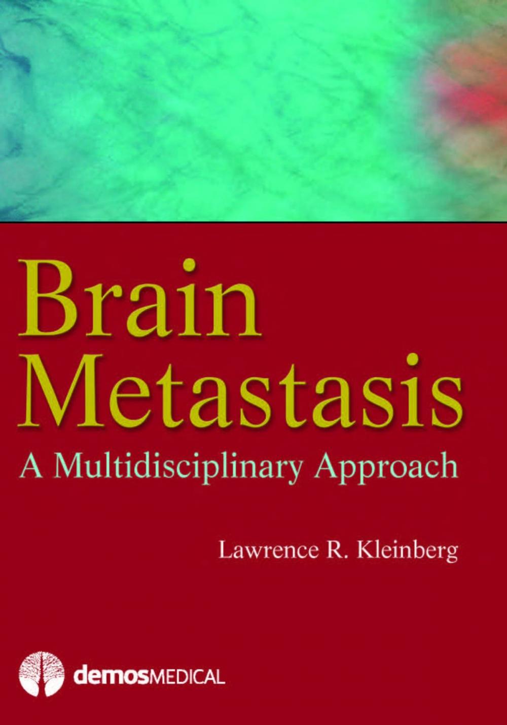 Big bigCover of Brain Metastasis