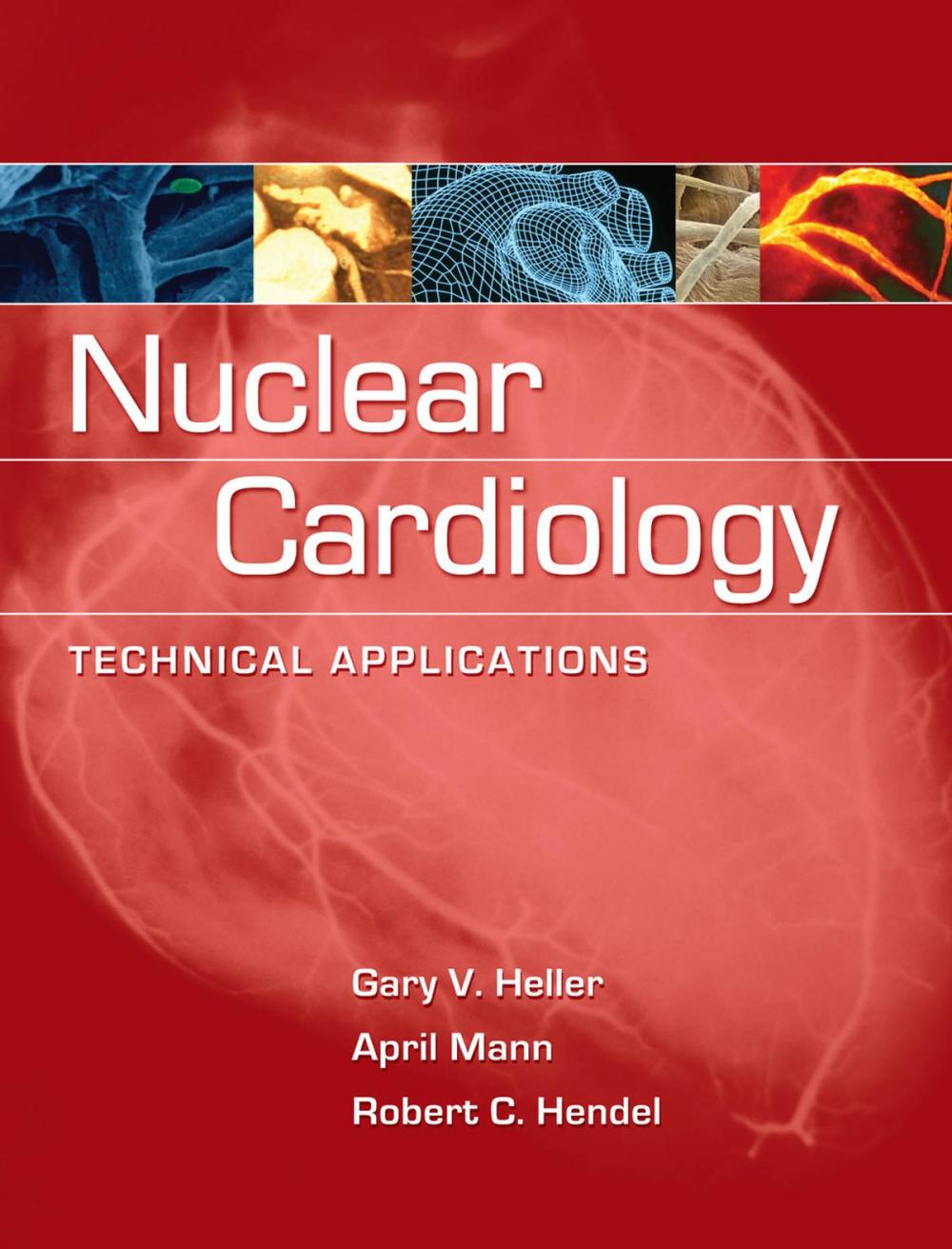 Big bigCover of Nuclear Cardiology: Technical Applications