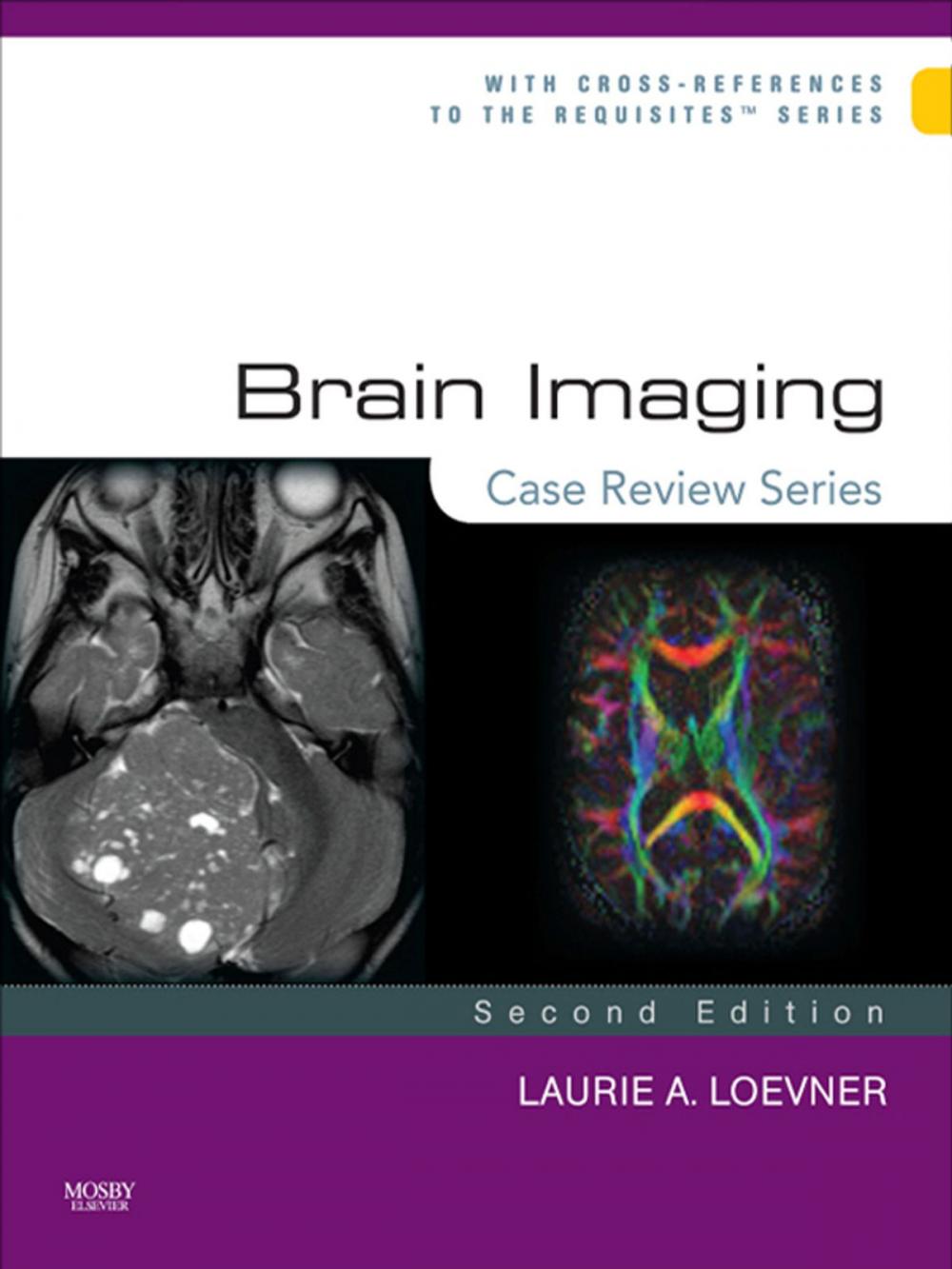 Big bigCover of Brain Imaging: Case Review Series E-Book