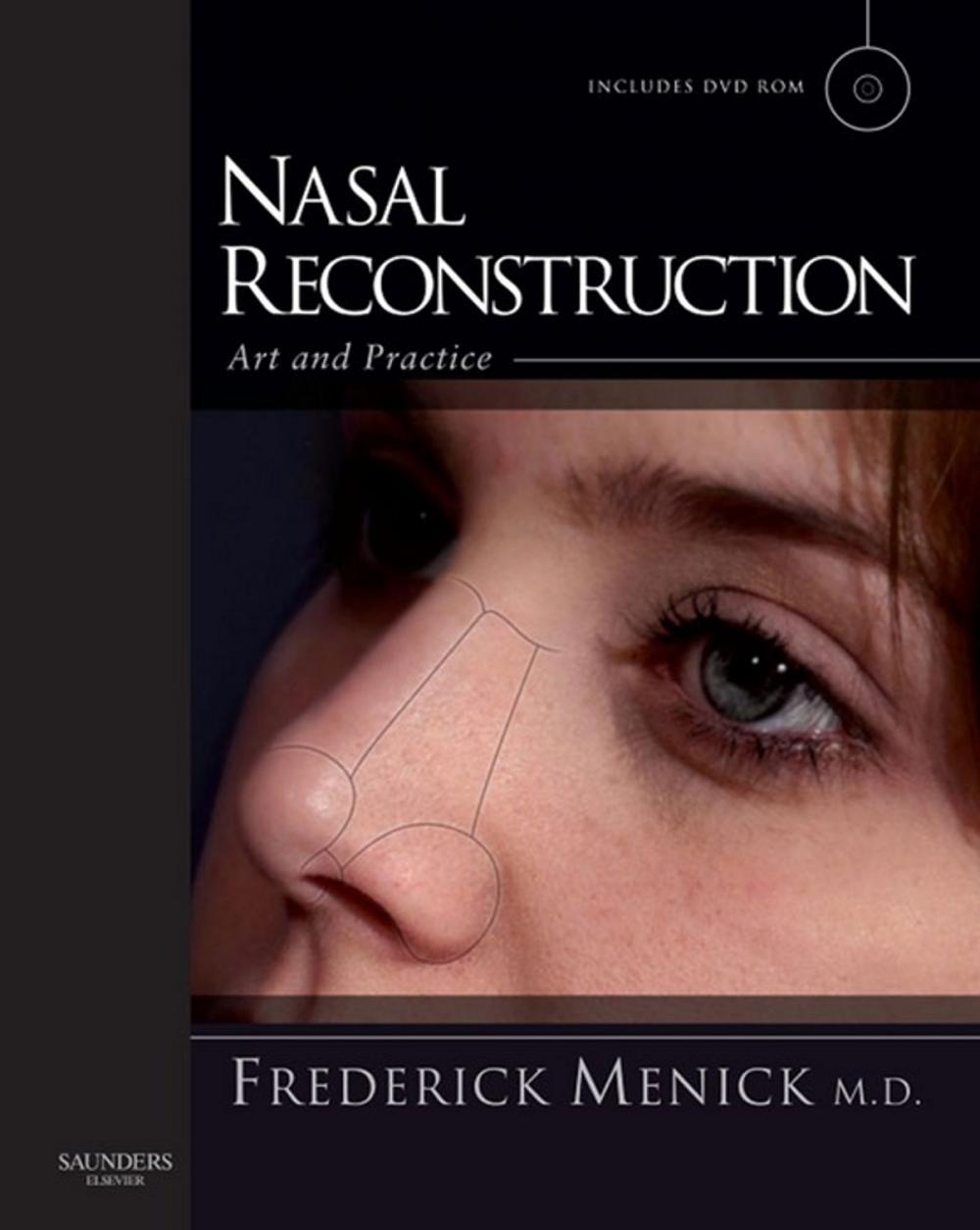 Big bigCover of Nasal Reconstruction: Art and Practice