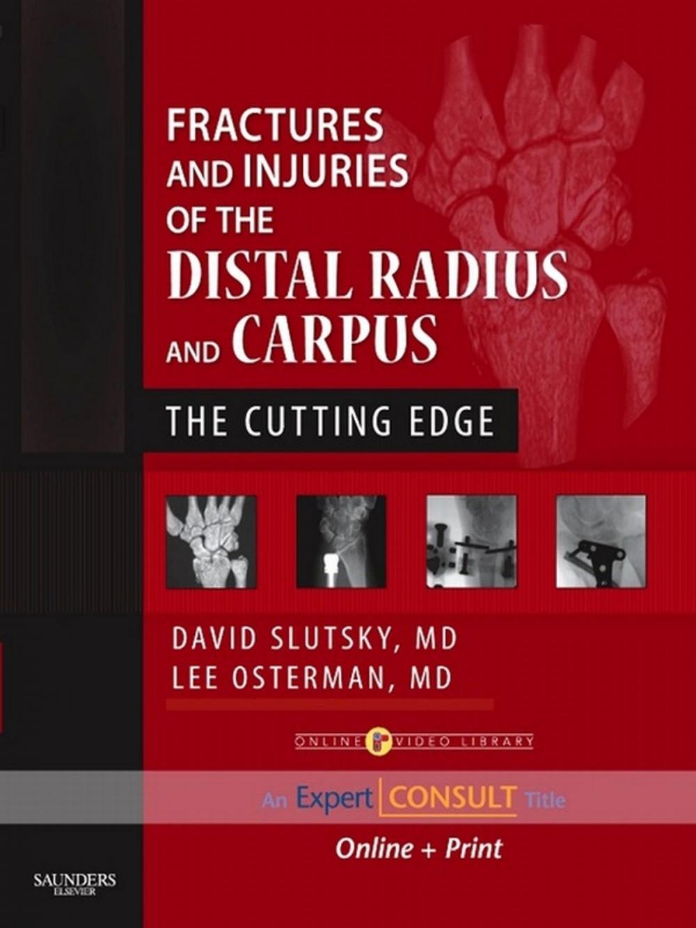 Big bigCover of Fractures and Injuries of the Distal Radius and Carpus E-Book