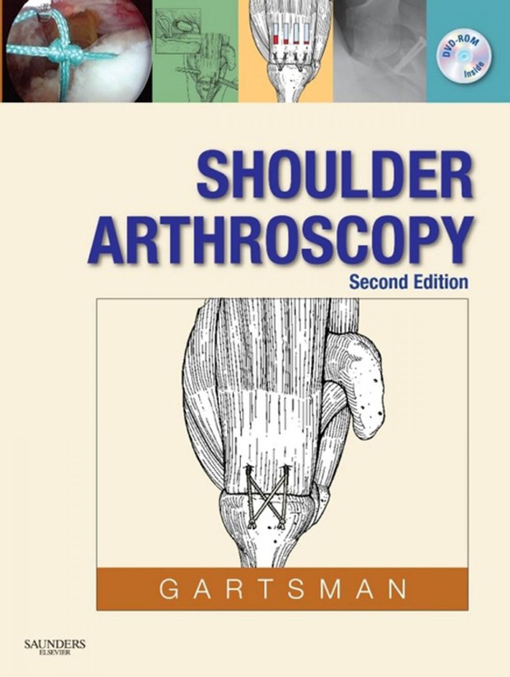 Big bigCover of Shoulder Arthroscopy E-Book