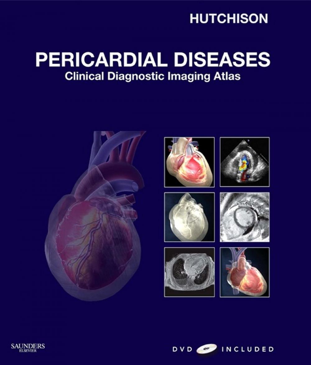 Big bigCover of Pericardial Diseases E-Book