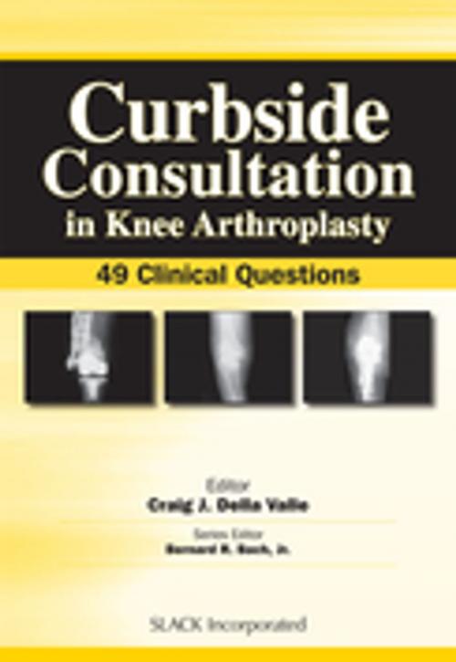 Cover of the book Curbside Consultation in Knee Arthroplasty by , SLACK Incorporated