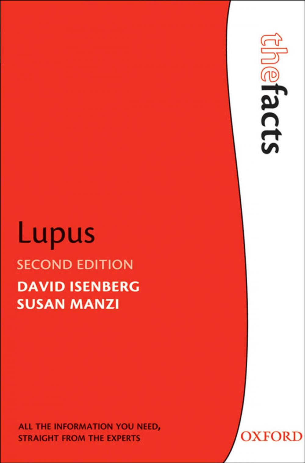 Big bigCover of Lupus