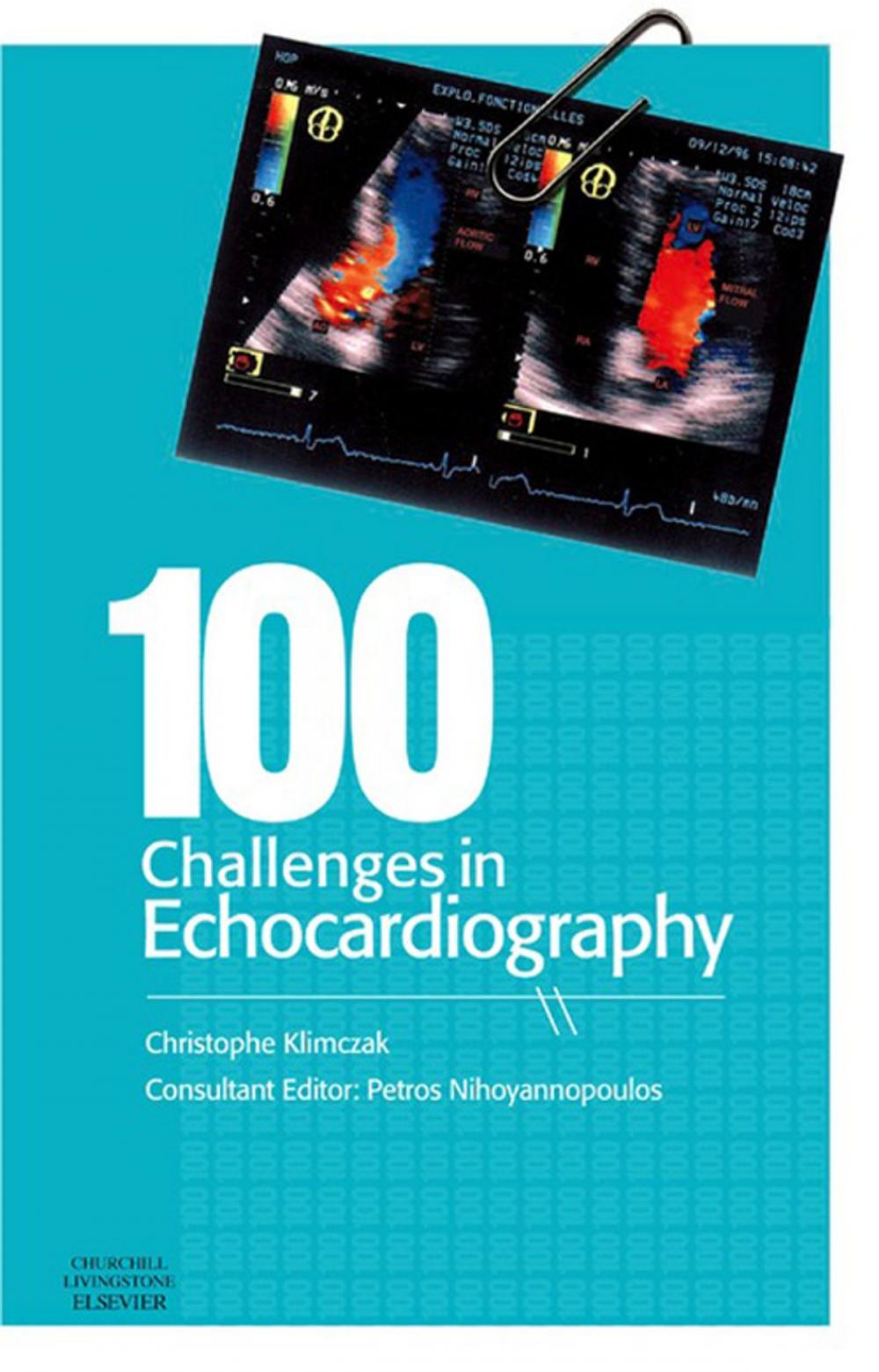 Big bigCover of 100 Challenges in Echocardiography E-Book