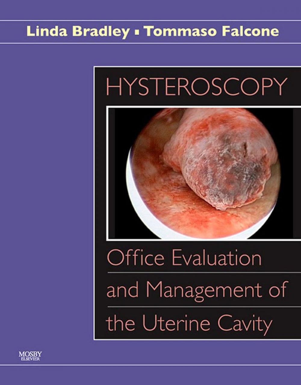 Big bigCover of Hysteroscopy: Office Evaluation and Management of the Uterine Cavity E-Book