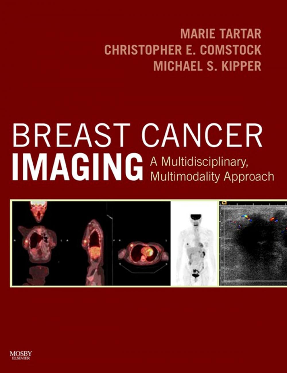 Big bigCover of Breast Cancer Imaging E-Book