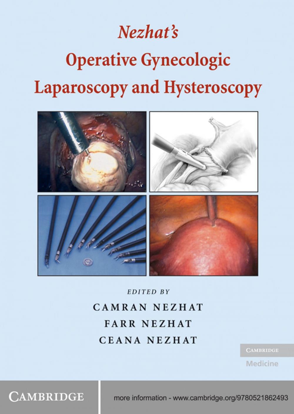 Big bigCover of Nezhat's Operative Gynecologic Laparoscopy and Hysteroscopy