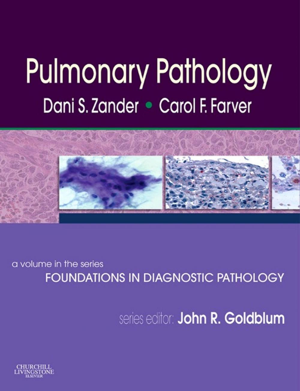 Big bigCover of Pulmonary Pathology E-Book