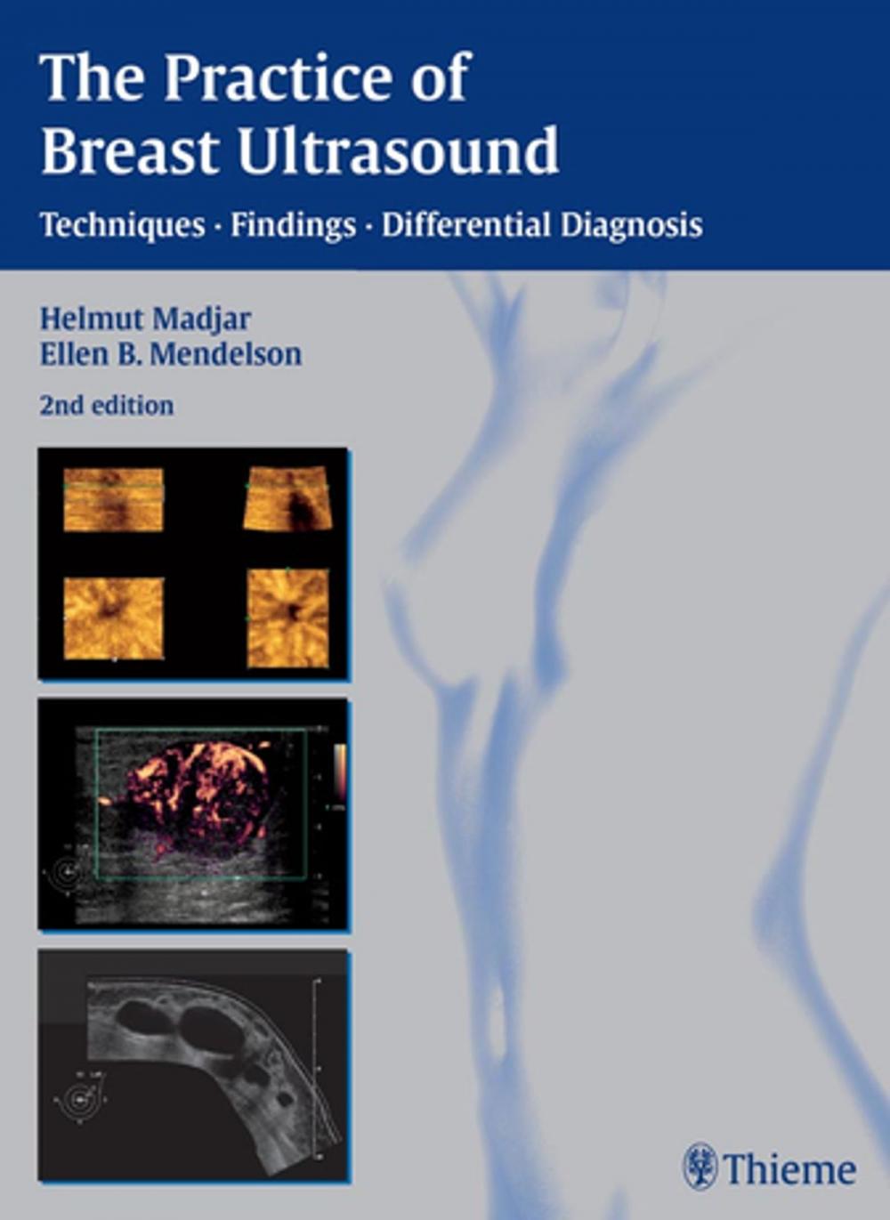 Big bigCover of The Practice of Breast Ultrasound