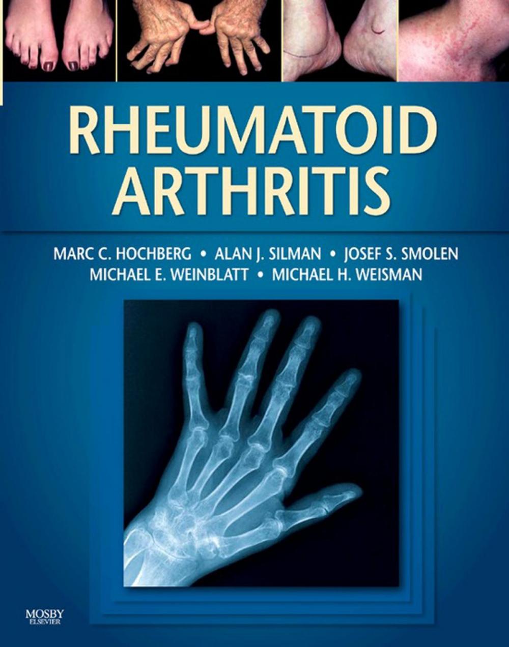 Big bigCover of Rheumatoid Arthritis E-Book