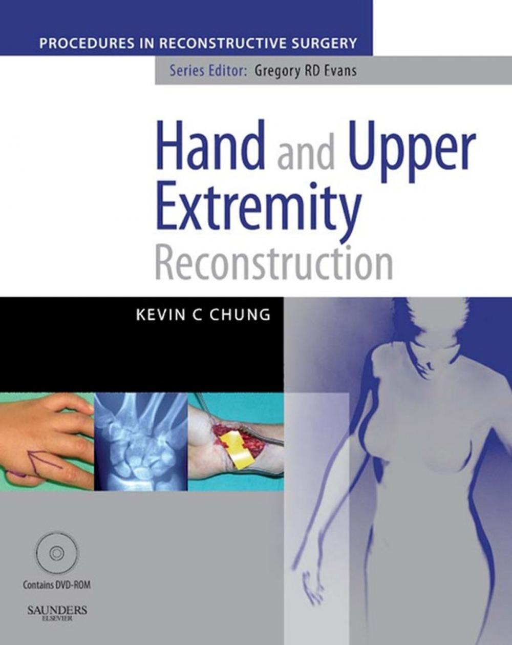 Big bigCover of Hand And Upper Extremity Reconstruction E-Book