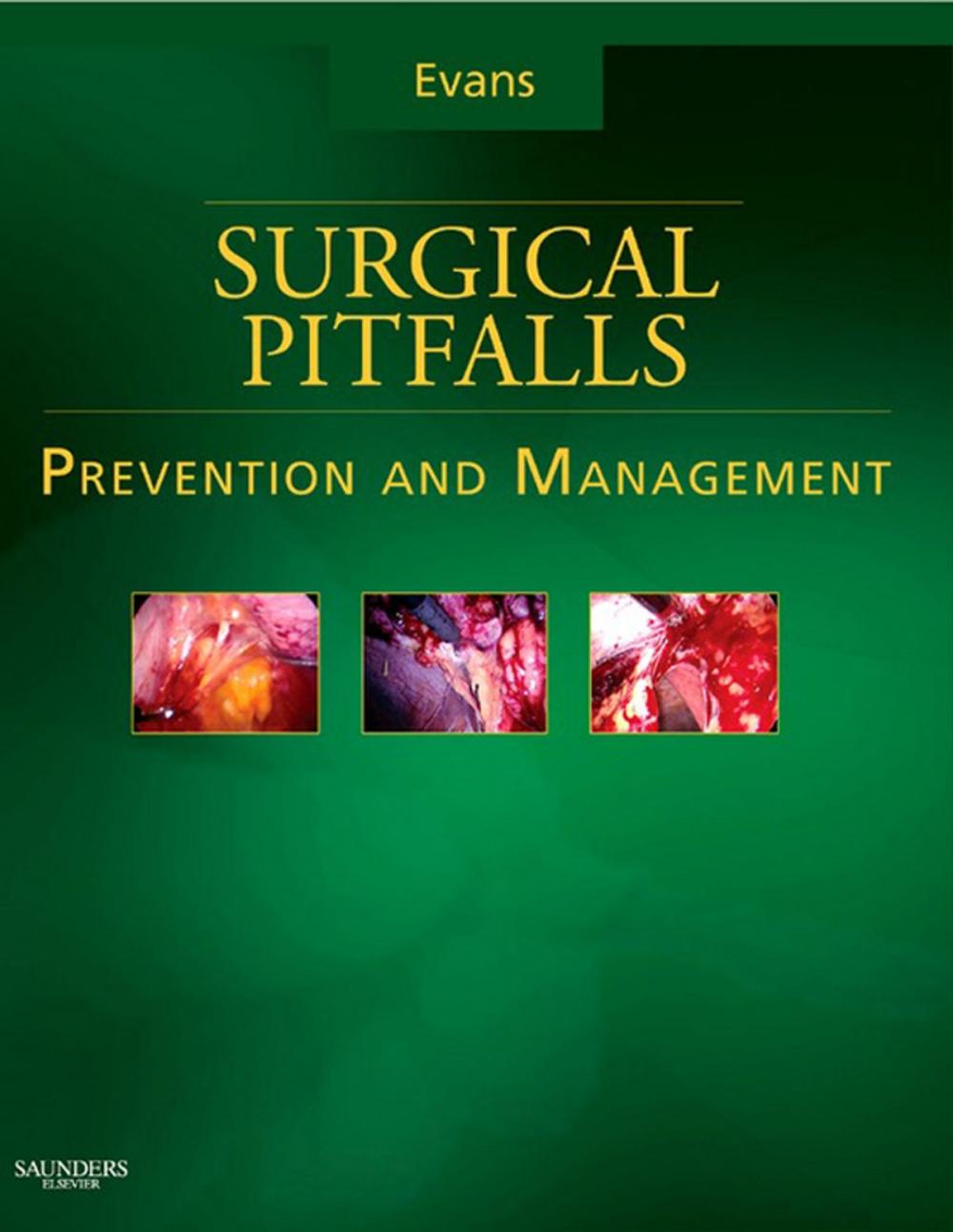 Big bigCover of Surgical Pitfalls E-Book