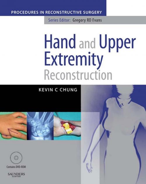 Cover of the book Hand And Upper Extremity Reconstruction E-Book by Kevin C. Chung, MD, MS, Elsevier Health Sciences