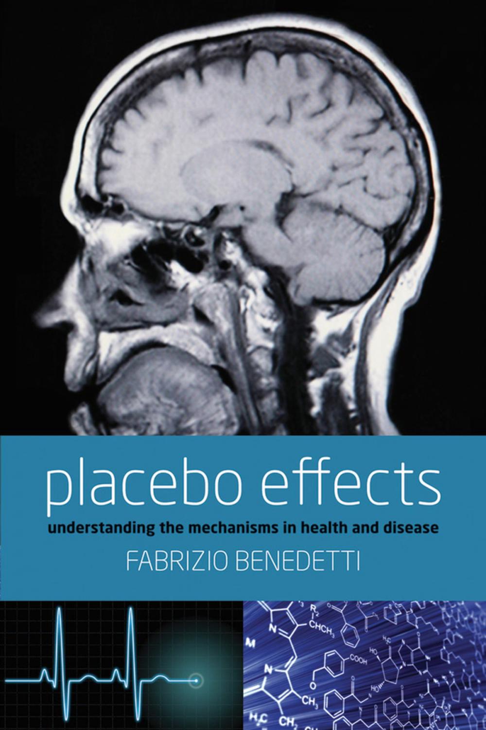 Big bigCover of Placebo Effects: Understanding the mechanisms in health and disease