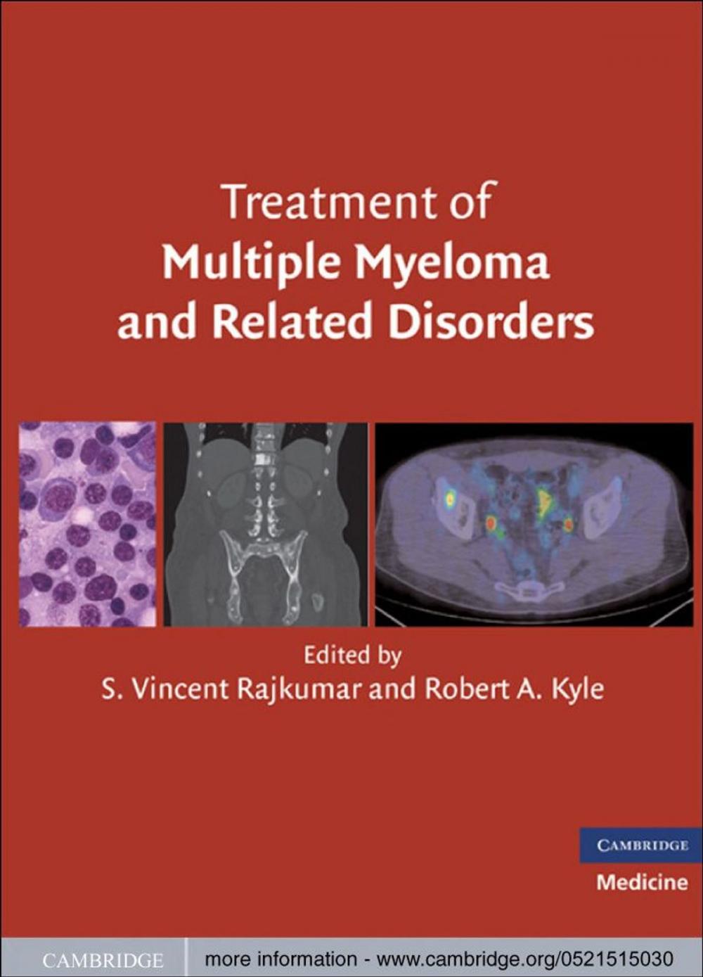 Big bigCover of Treatment of Multiple Myeloma and Related Disorders