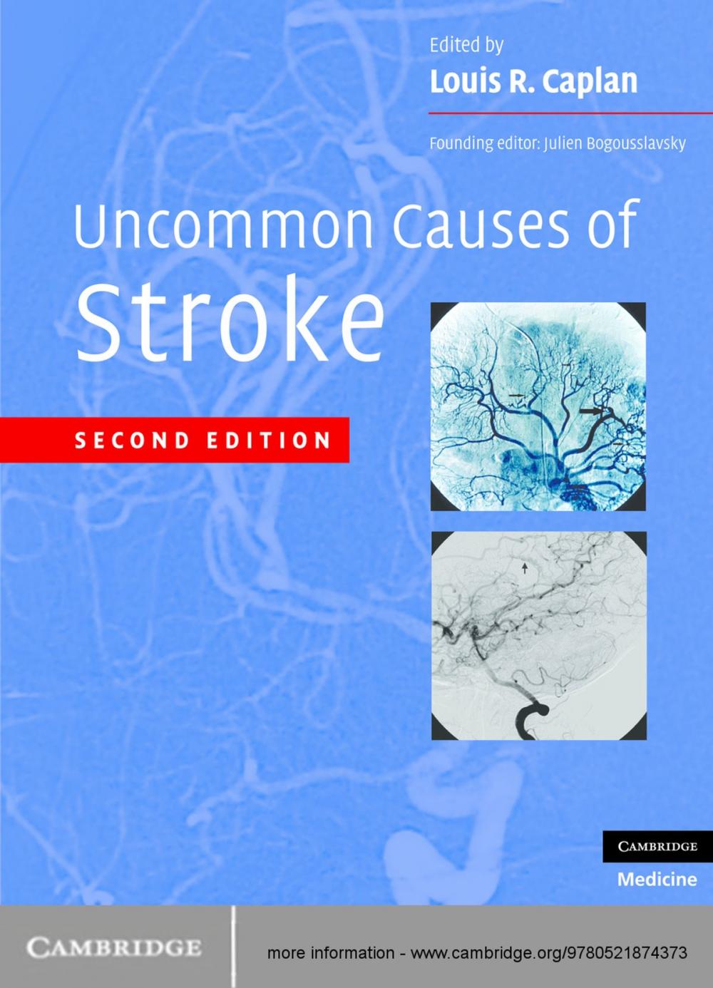 Big bigCover of Uncommon Causes of Stroke