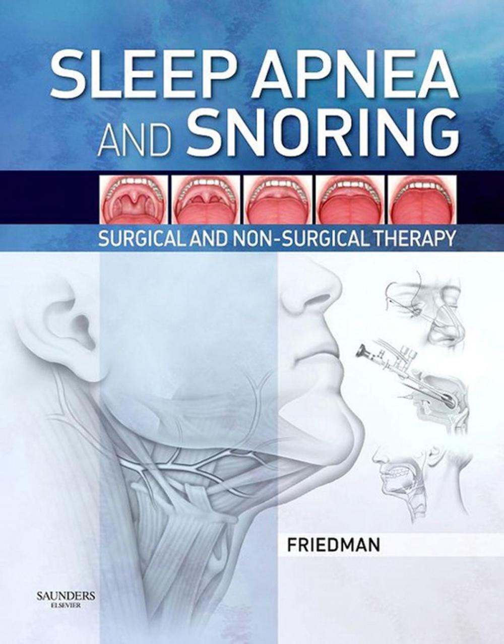 Big bigCover of Sleep Apnea and Snoring E-Book