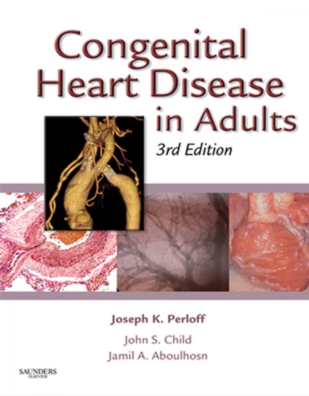 Big bigCover of Congenital Heart Disease in Adults E-Book