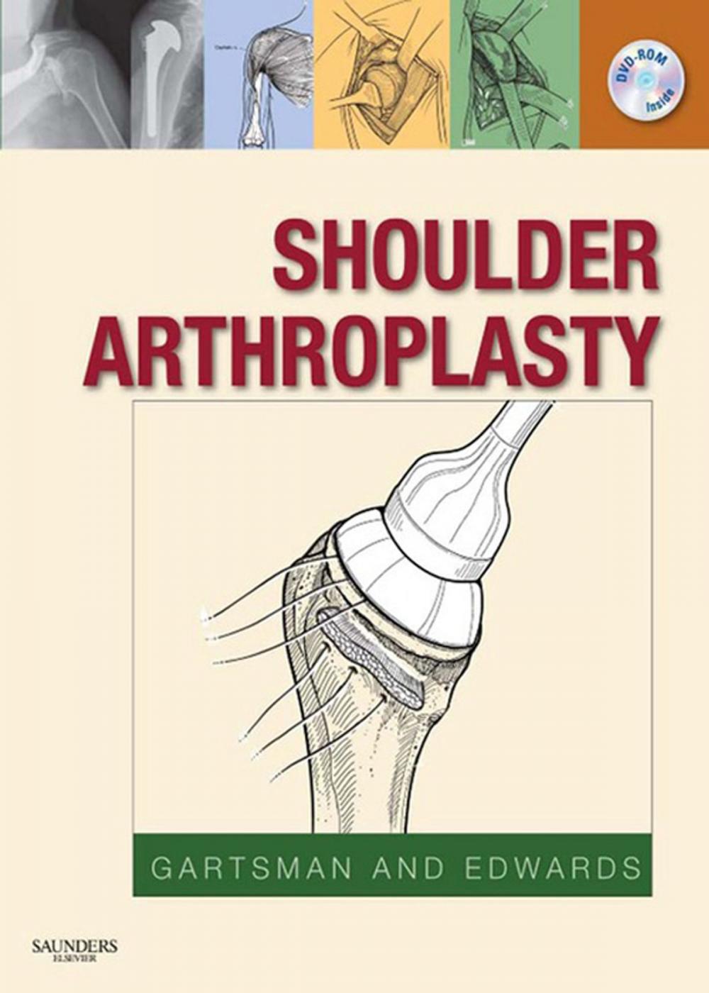 Big bigCover of Shoulder Arthroplasty E-Book