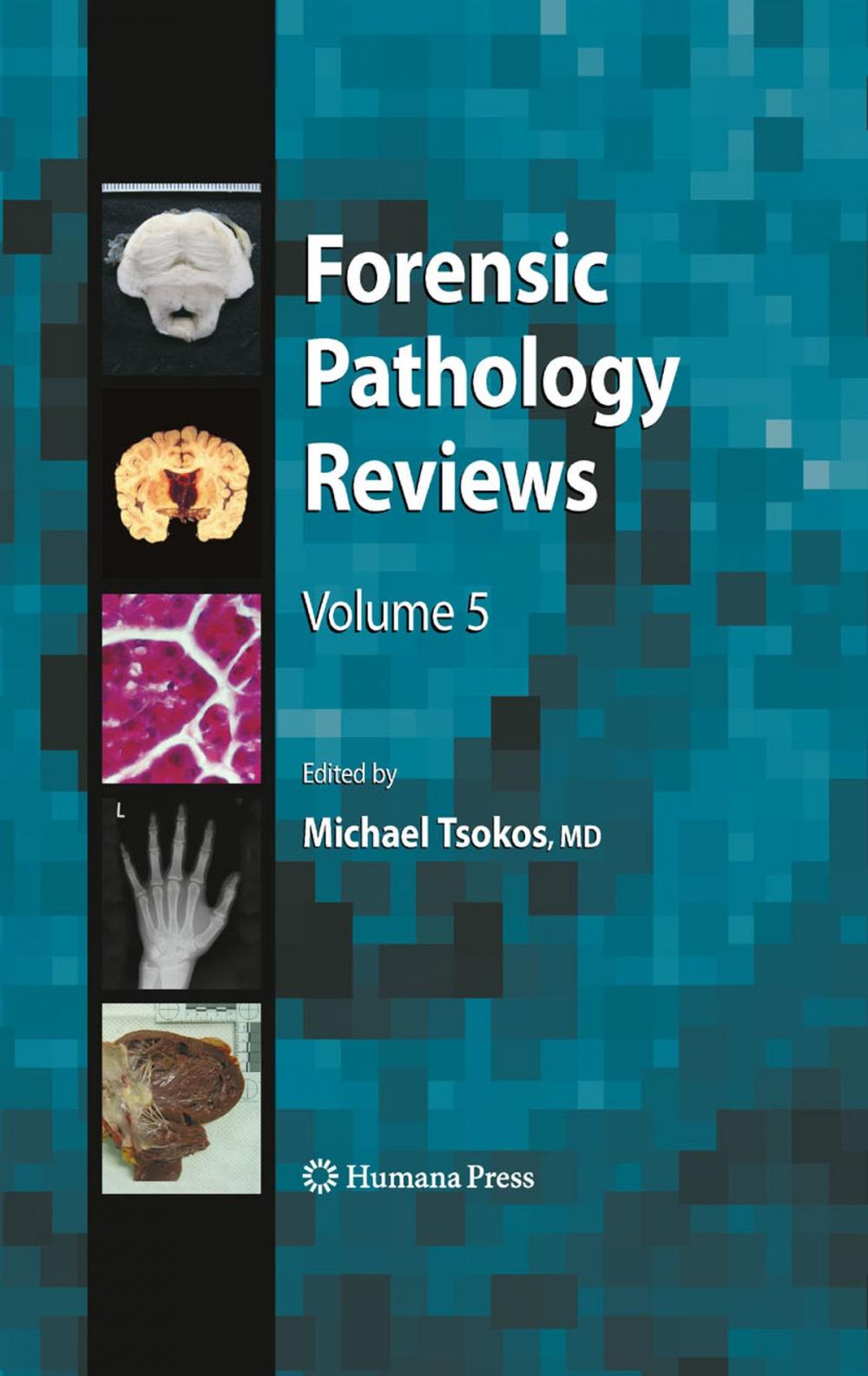 Big bigCover of Forensic Pathology Reviews 5