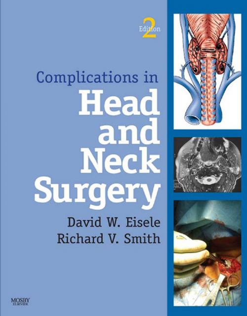 Cover of the book Complications in Head and Neck Surgery E-Book by David Eisele, MD, Richard V. Smith, MD, FACS, Elsevier Health Sciences