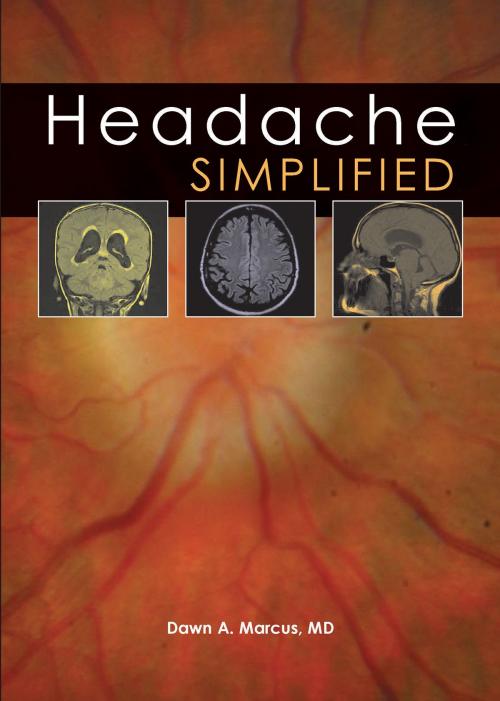 Cover of the book Headache Simplified by Dawn Marcus, tfm Publishing Ltd