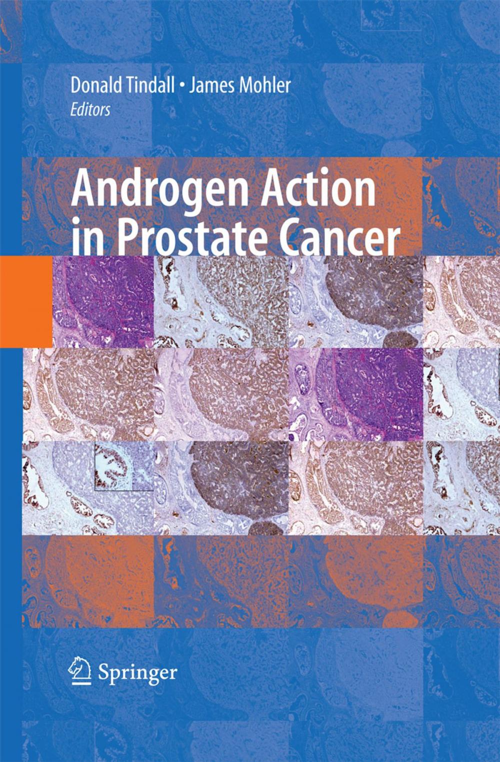 Big bigCover of Androgen Action in Prostate Cancer