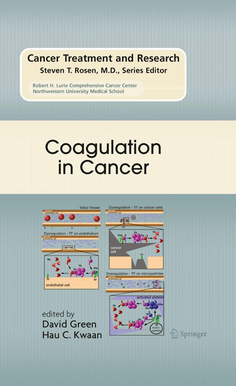 Big bigCover of Coagulation in Cancer