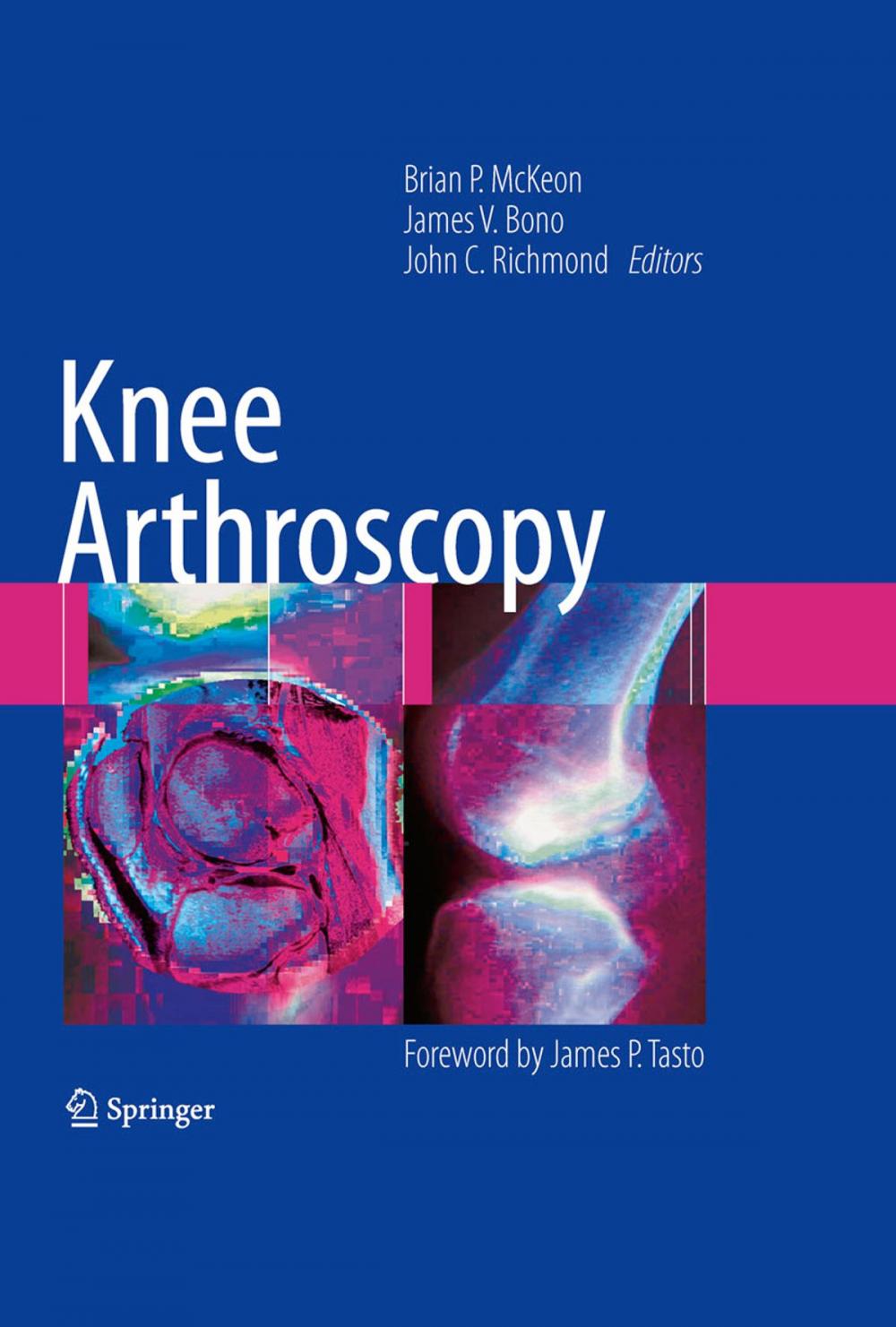 Big bigCover of Knee Arthroscopy