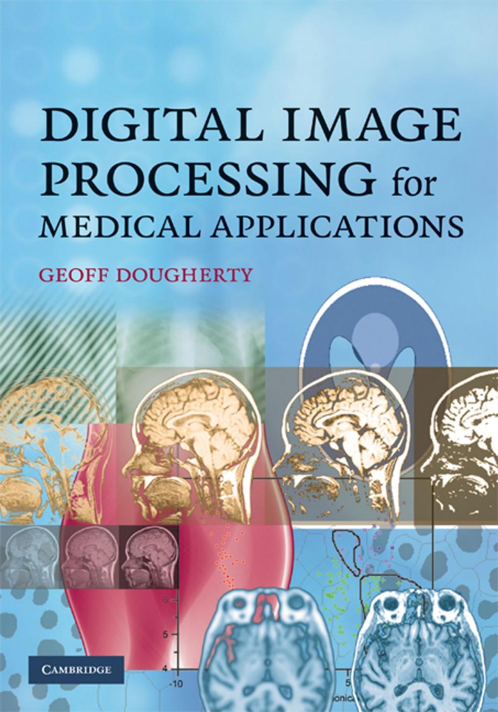 Big bigCover of Digital Image Processing for Medical Applications