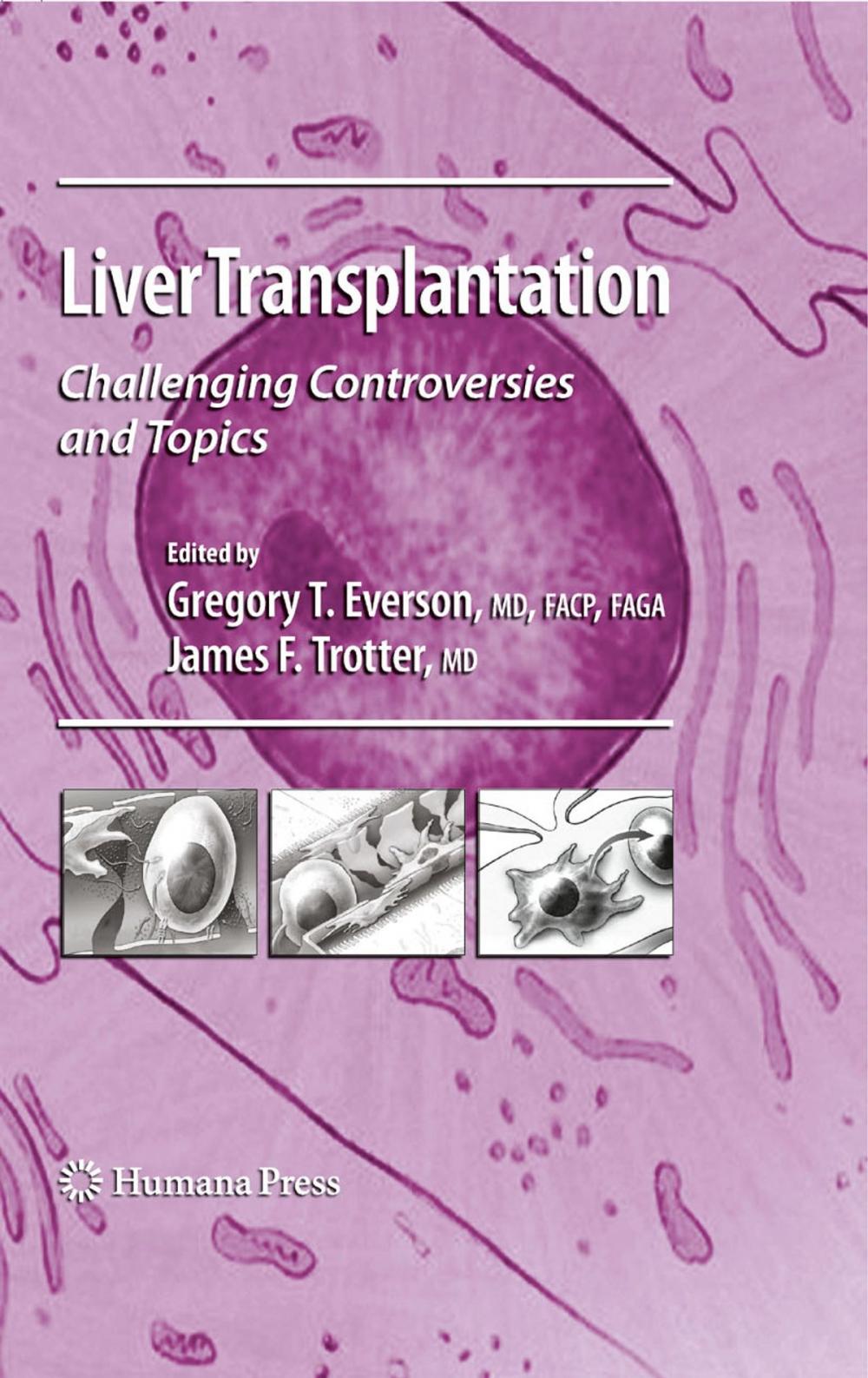 Big bigCover of Liver Transplantation