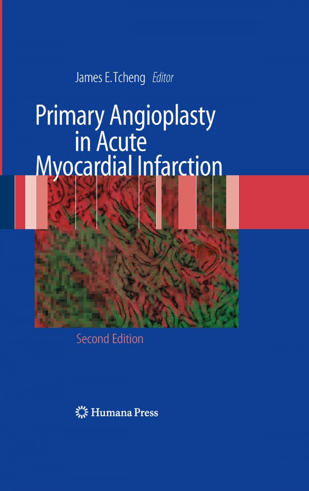 Big bigCover of Primary Angioplasty in Acute Myocardial Infarction