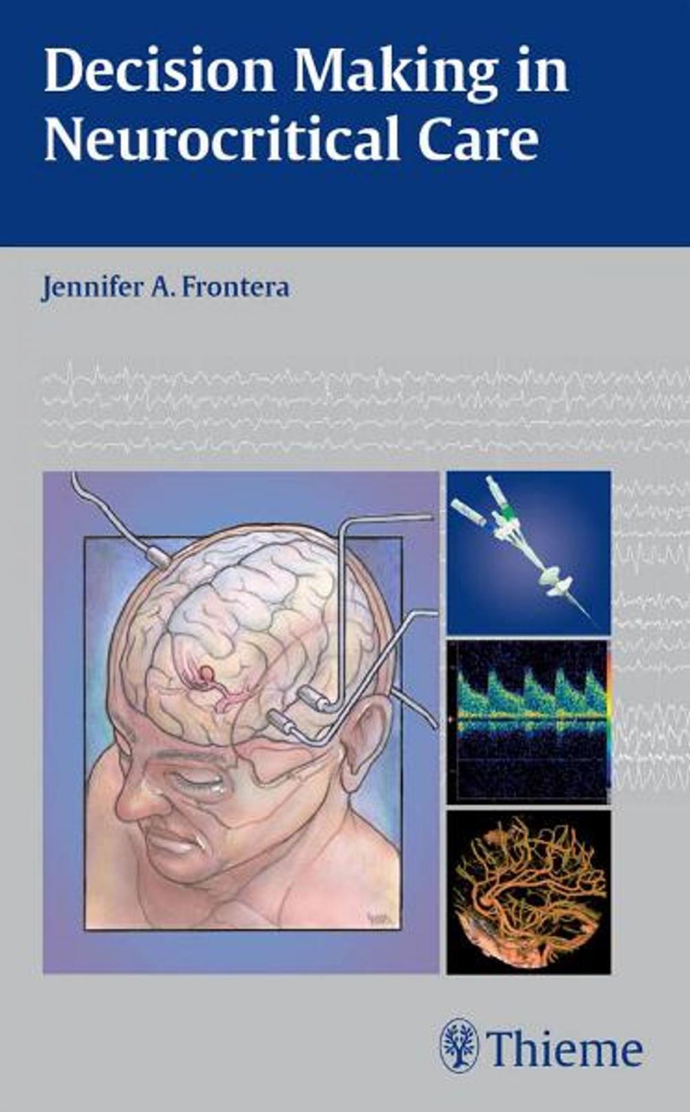 Big bigCover of Decision Making in Neurocritical Care