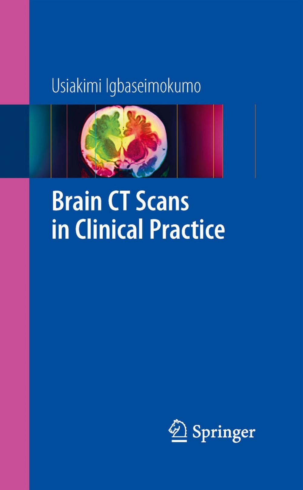 Big bigCover of Brain CT Scans in Clinical Practice