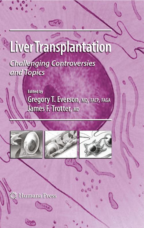 Cover of the book Liver Transplantation by , Humana Press