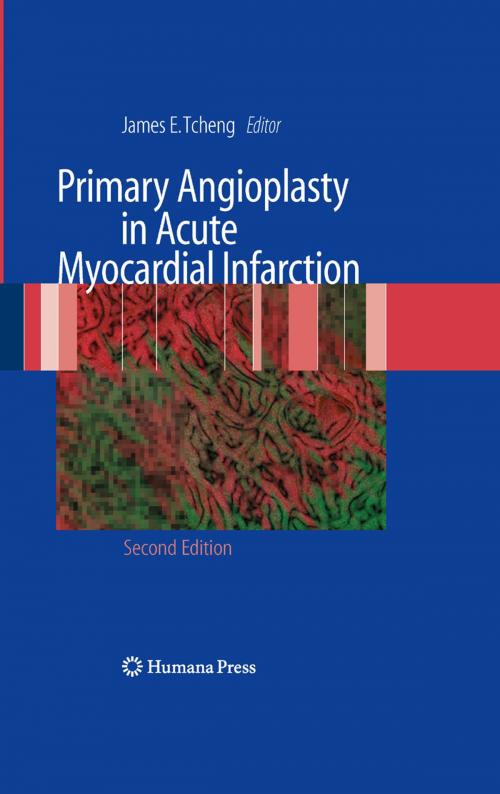 Cover of the book Primary Angioplasty in Acute Myocardial Infarction by , Humana Press