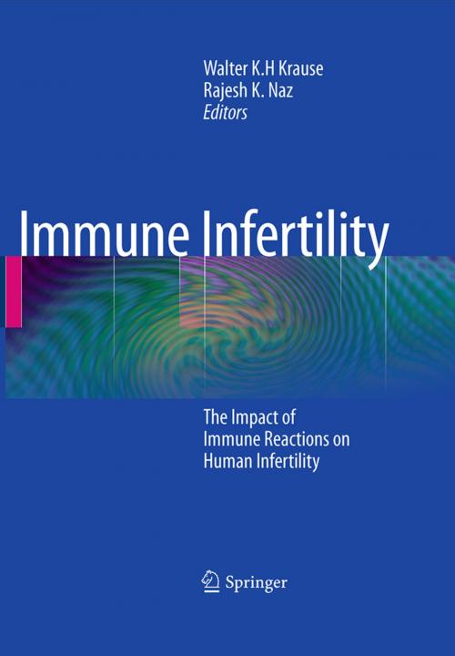 Cover of the book Immune Infertility by , Springer Berlin Heidelberg