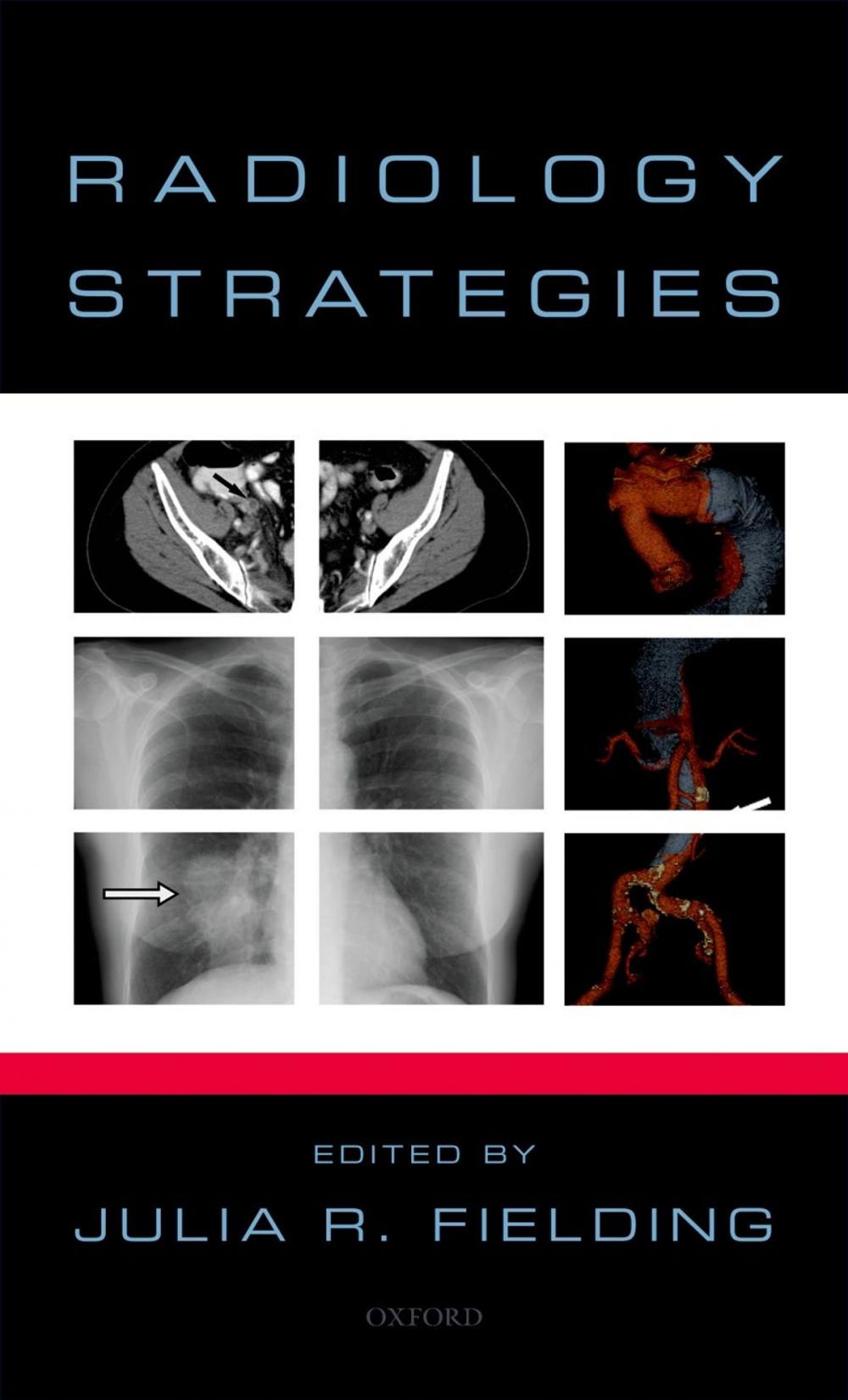 Big bigCover of Radiology Strategies