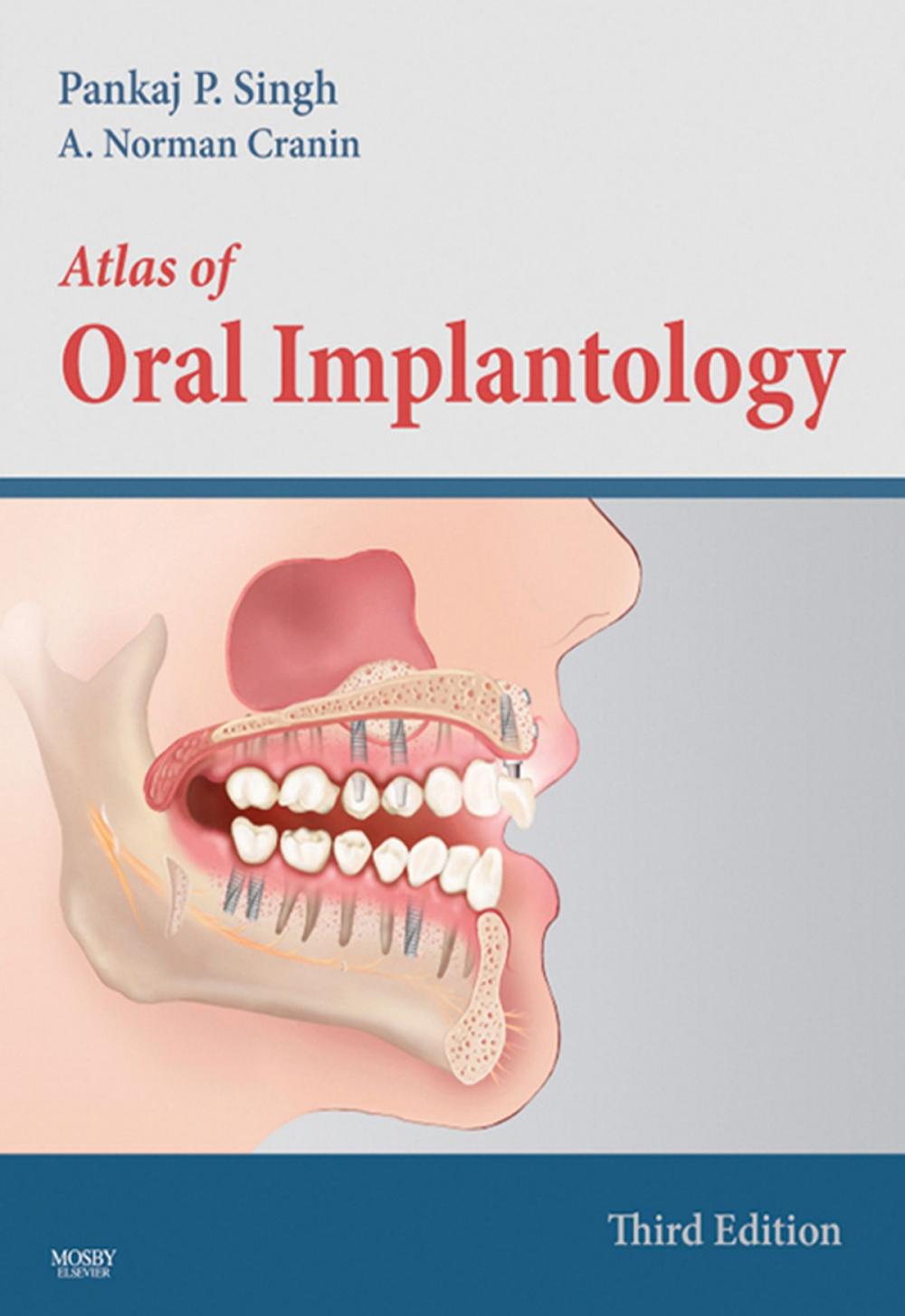 Big bigCover of Atlas of Oral Implantology - E-Book