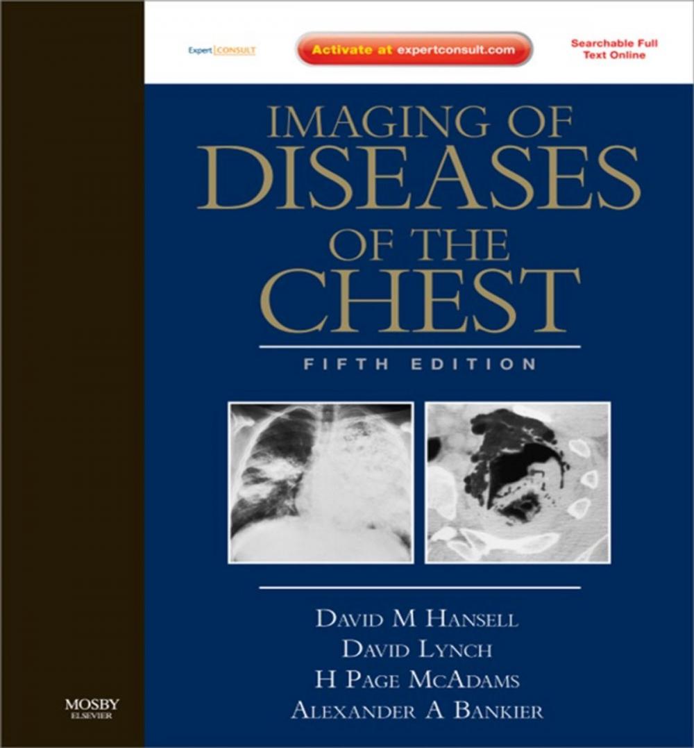 Big bigCover of Imaging of Diseases of the Chest E-Book