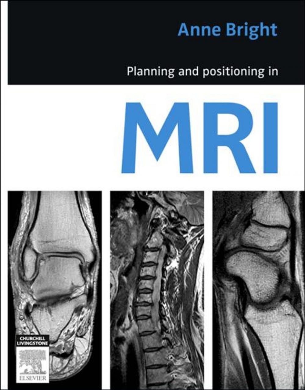 Big bigCover of Planning and Positioning in MRI