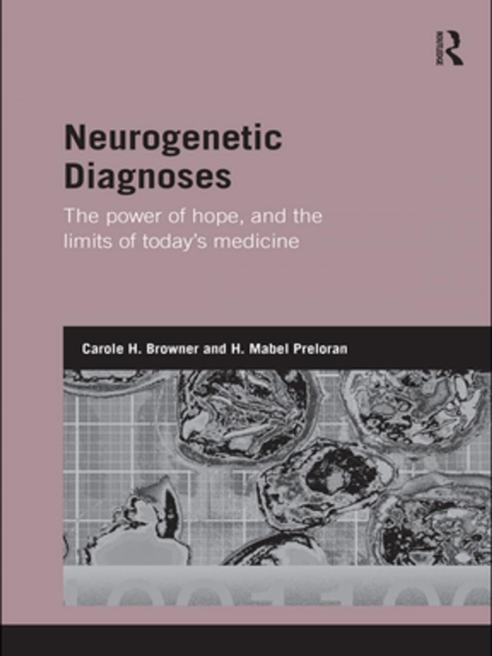 Big bigCover of Neurogenetic Diagnoses