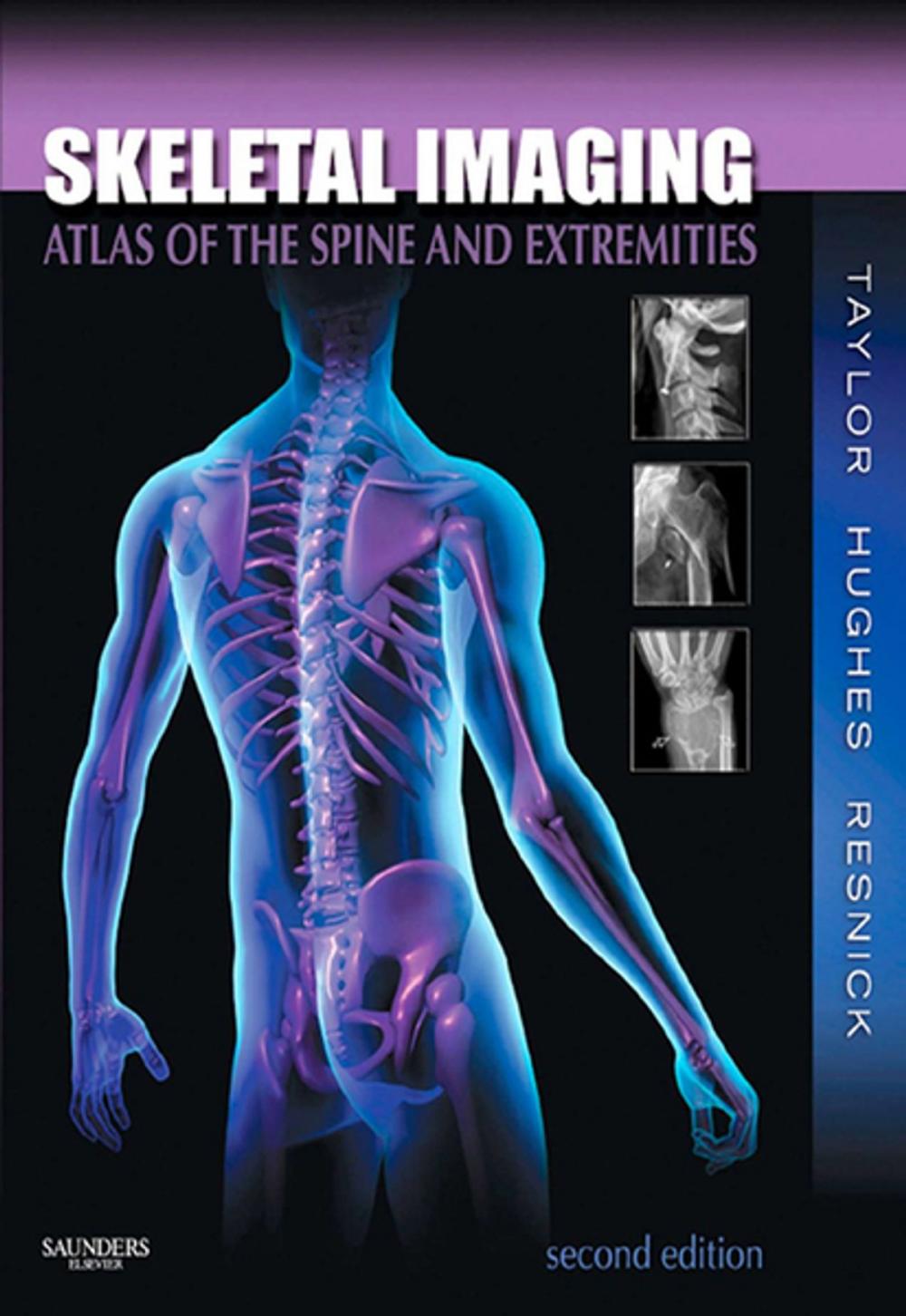 Big bigCover of Skeletal Imaging - E-Book