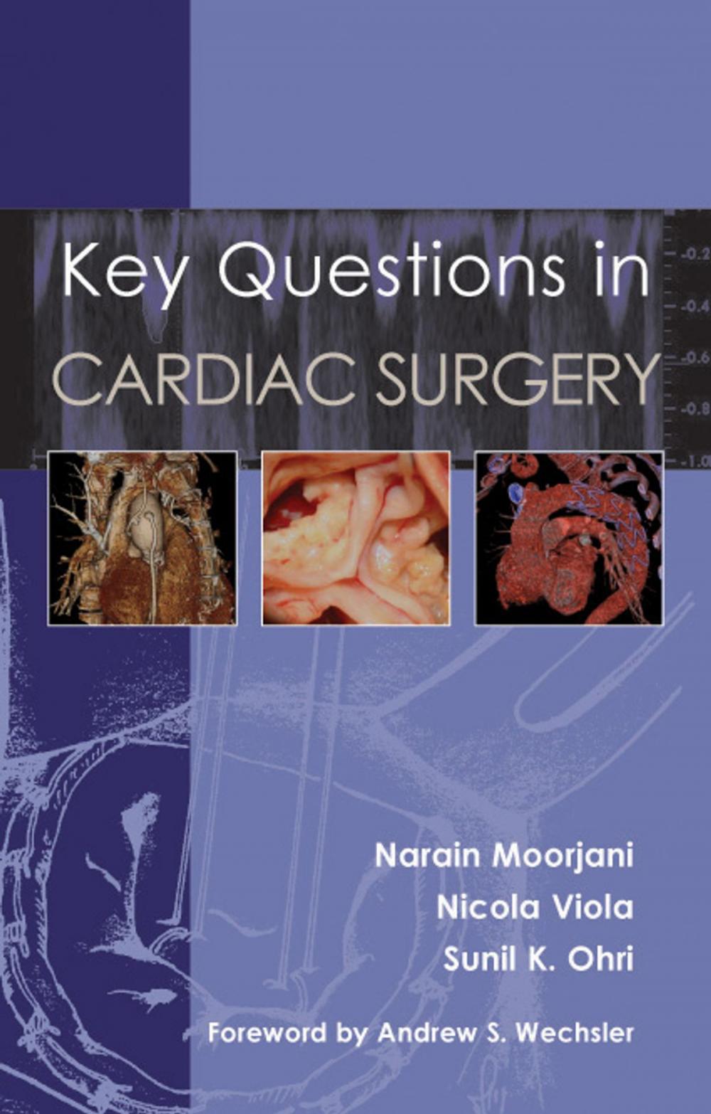 Big bigCover of Key Questions in Cardiac Surgery